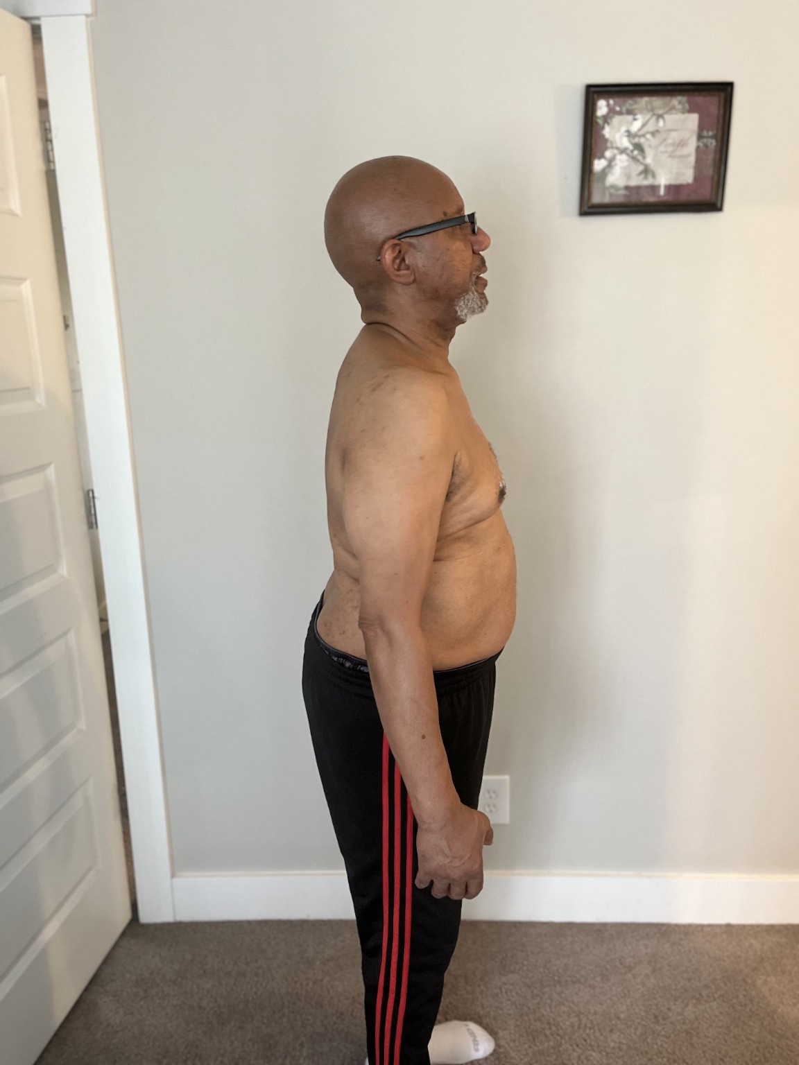 Age 75 client after 3 weeks of training, side view
